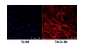 荧光标记MYCNsiRNA 转染LA-N-5细胞