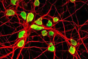 荧光标记介孔二氧化硅纳米颗粒