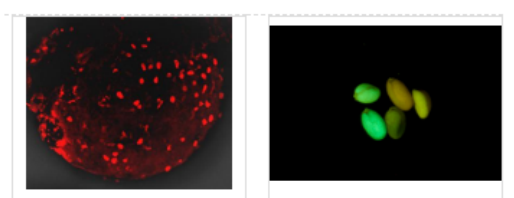 荧光标记自噬底物蛋白p62