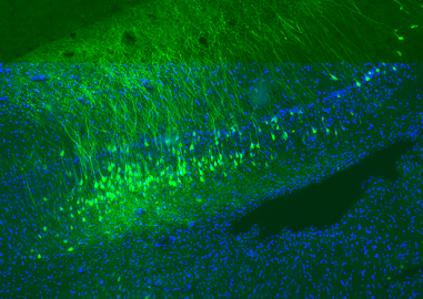 荧光标记内质网跨膜蛋白PERK