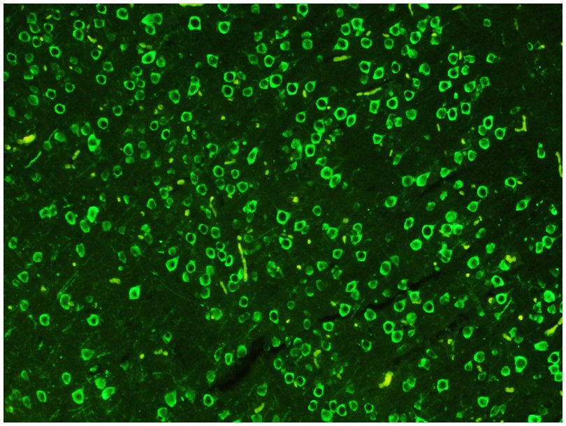 Heparin-FITC 绿色荧光素标记肝素